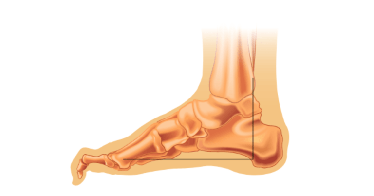 Dedos en martillo-1200x628-1