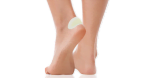 Ampolla en el pie cubierta con un apósito para ampollas