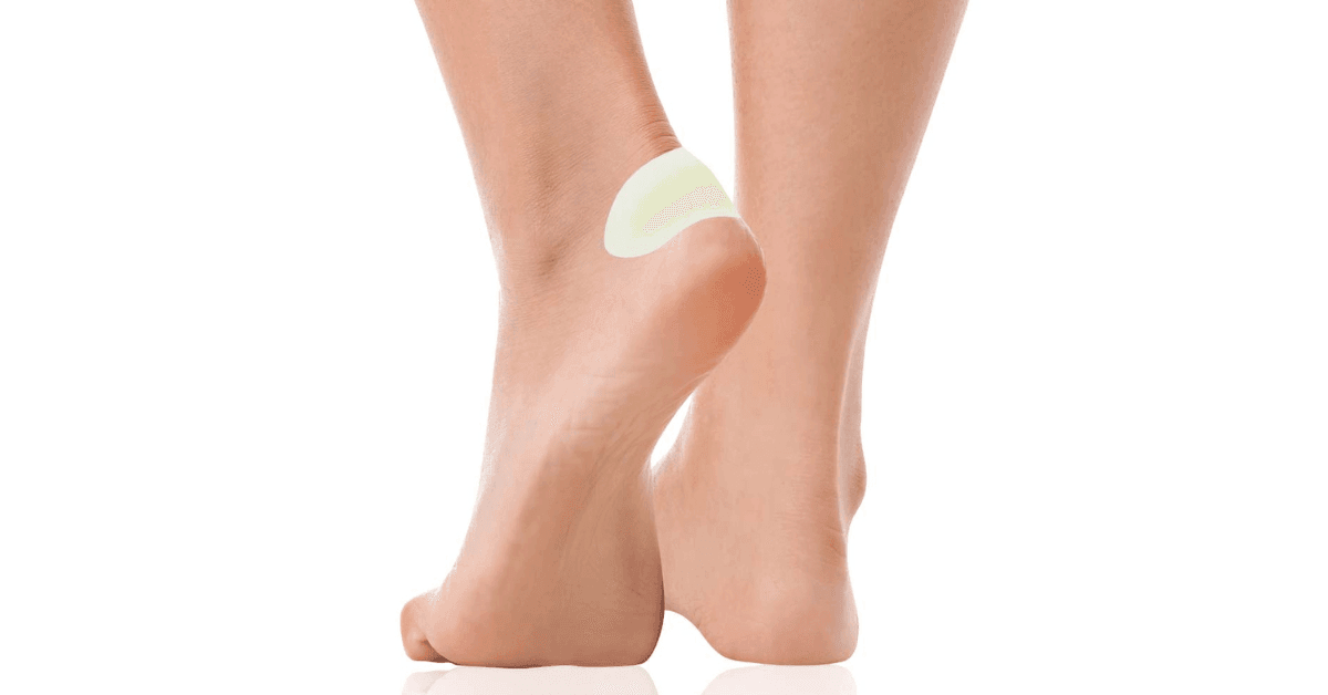 Ampolla en el pie cubierta con un apósito para ampollas